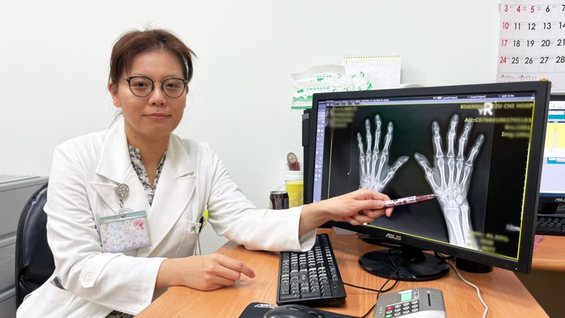 全身爆痛無法翻身及行走   竟因類風濕性關節炎惹禍！