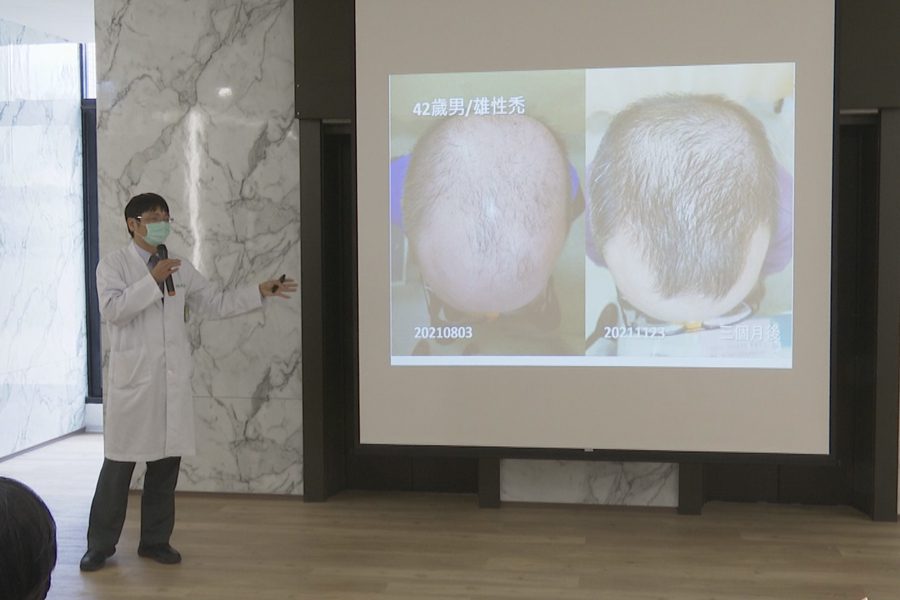 男性注重「面子」比率升  頭髮問題最受矚